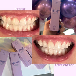 💜🦷ultraviolet pearly whites brightening gel🦷💜